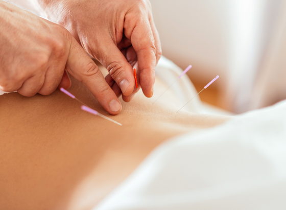 acupuncture-in-addiction-treatment-person-recieving-treatment-2